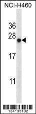 Anti-BAG2 (C-term) Antibody