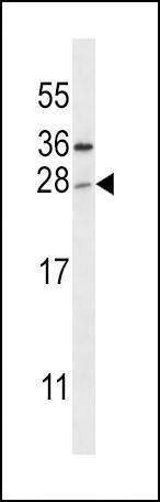 Anti-TICAM2 (N-term) Antibody