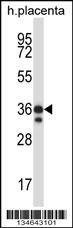 Anti-Mst4 (Center) Antibody