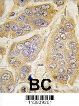 Anti-Nanos Homologue 1 (NANOS1) (C-term) Antibody