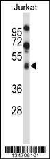 Anti-SPN/CD43 (Center) Antibody