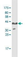 Anti-CHEK2 Antibody