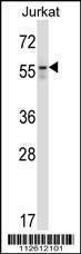 Anti-BECN1 (N-term T72) Antibody