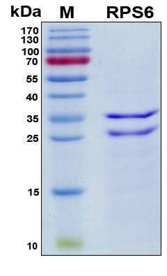 Recombinant Human 40S RP S6 Protein, Antigen Grade