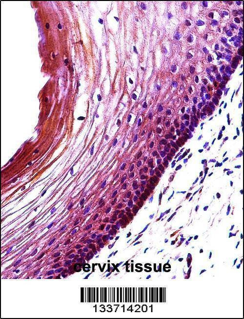 Anti-BBC3 (Center) Antibody