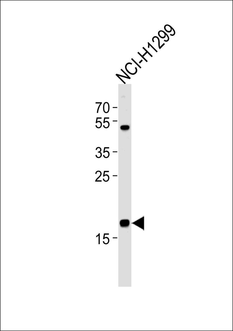 Anti-CFL2 (N-term) Antibody