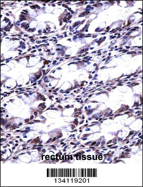 Anti-CFL2 (N-term) Antibody