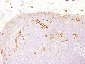 Anti-vWF Antibody