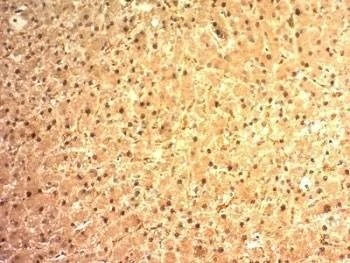 Anti-Arginase 1 Antibody