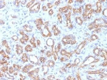 Anti-Beta Catenin Antibody