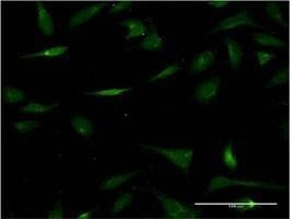 Anti-CHST3 Antibody