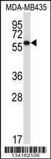 Anti-PDIA5 (C-term) Antibody