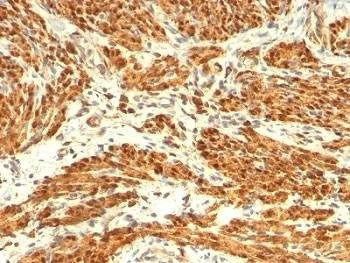 Anti-Calponin Antibody Cocktail