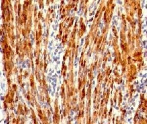 Anti-Calponin Antibody