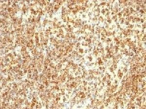 Anti-CD20 Antibody Cocktail