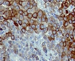 Anti-CD271 Antibody