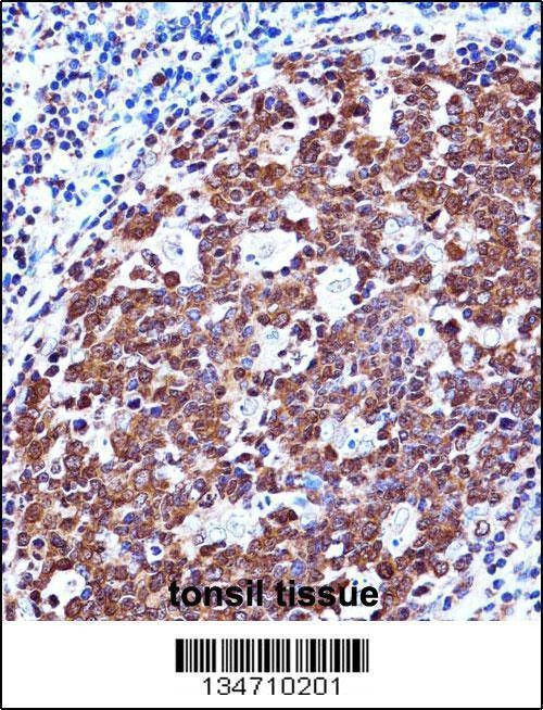 Anti-ZAP70 (Center) Antibody