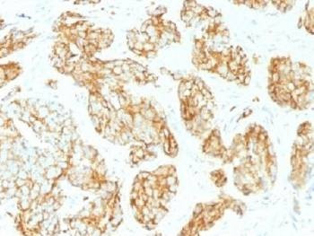 Anti-CD44v9 Antibody