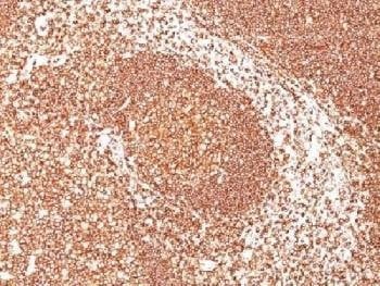 Anti-CD45 Antibody (Leukocyte marker)