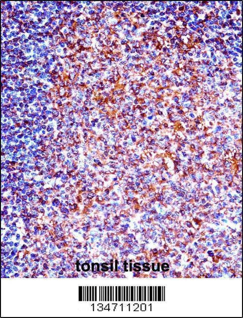 Anti-ZAP70 (N-term) Antibody