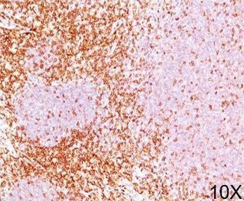 Anti-CD6 Antibody
