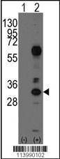 Anti-CD8A (N-term) Antibody