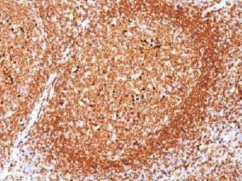 Anti-CD79a Antibody