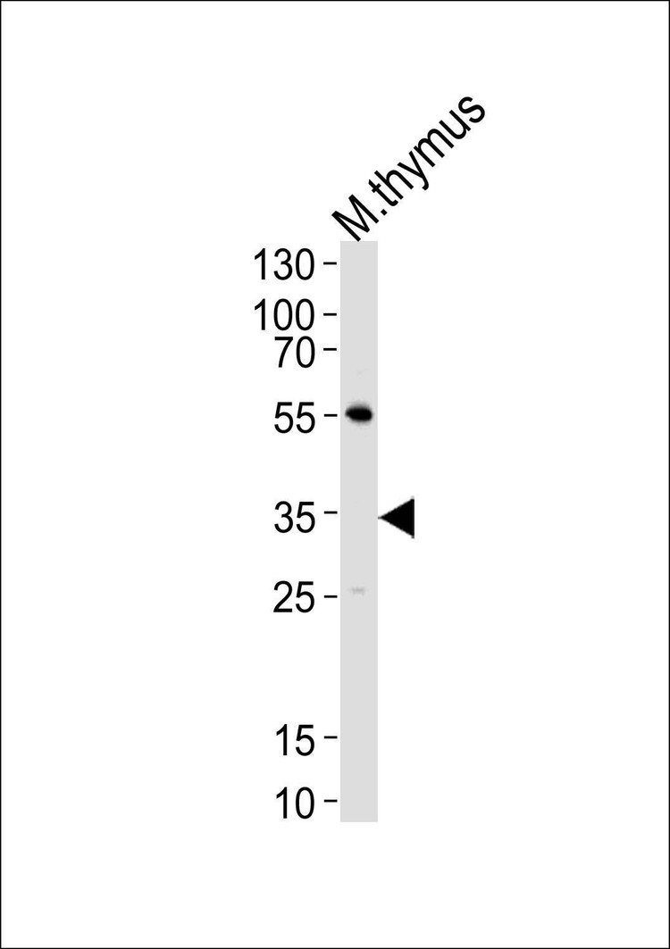 Anti-Mouse Lck (N-term) Antibody