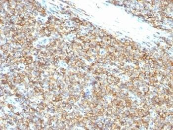 Anti-CD99 Antibody