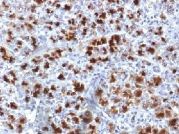 Anti-CELA3B / Elastase 3B Antibody
