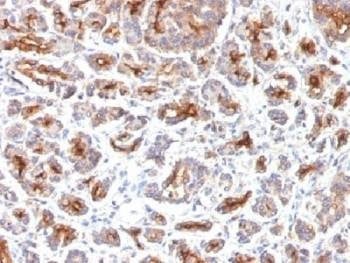 Anti-CFTR Antibody