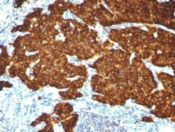Anti-Chromogranin A Antibody Cocktail
