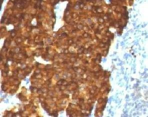 Anti-Chromogranin A Antibody