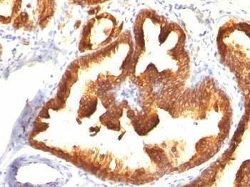 Anti-CK18 Antibody