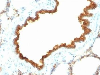 Anti-CK19 Antibody