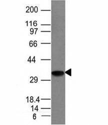 Anti-CLIP Antibody