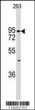 Anti-K Cadherin (CDH6) (C-term) Antibody