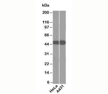 Anti-Cytokeratin 18 Antibody