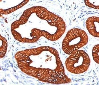 Anti-Cytokeratin 18 Antibody