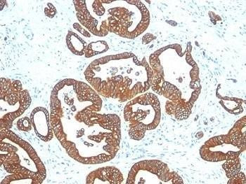Anti-Cytokeratin 18 Antibody