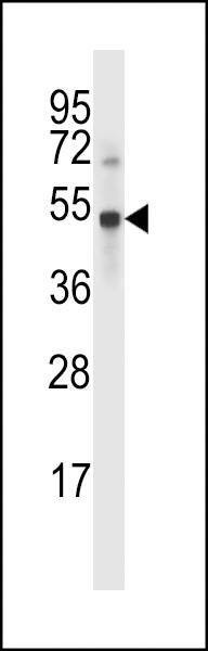 Anti-UBP46 (C-term) Antibody