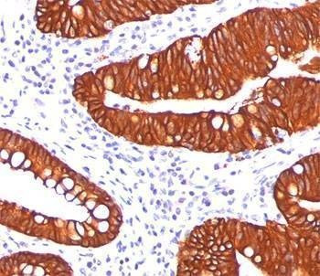 Anti-Cytokeratin 19 Antibody