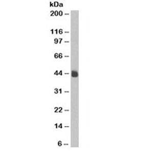 Anti-Cytokeratin 5 + 8 Antibody