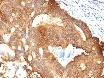 Anti-Cytokeratin 8 Antibody