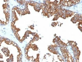 Anti-Cytokeratin 8/18 Antibody