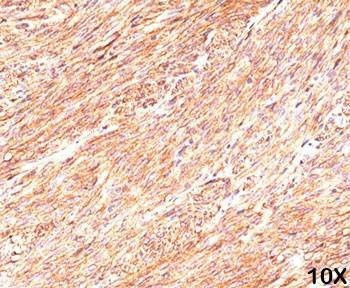 Anti-DOG1 Antibody