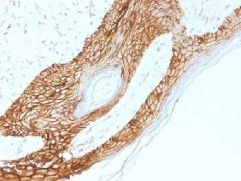 Anti-E-Cadherin / CDH1 Antibody