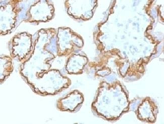Anti-E-Cadherin / CDH1 Antibody