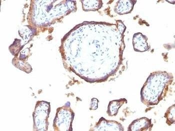 Anti-EGFR Antibody
