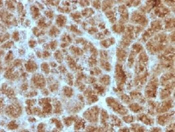 Anti-CELA3B / Elastase 3B Antibody